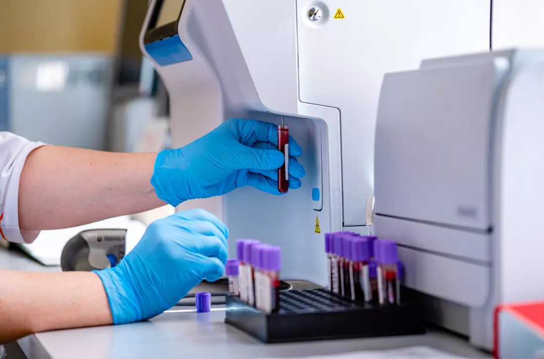 probowki-w-analizatorze-laboratorium-medyczne