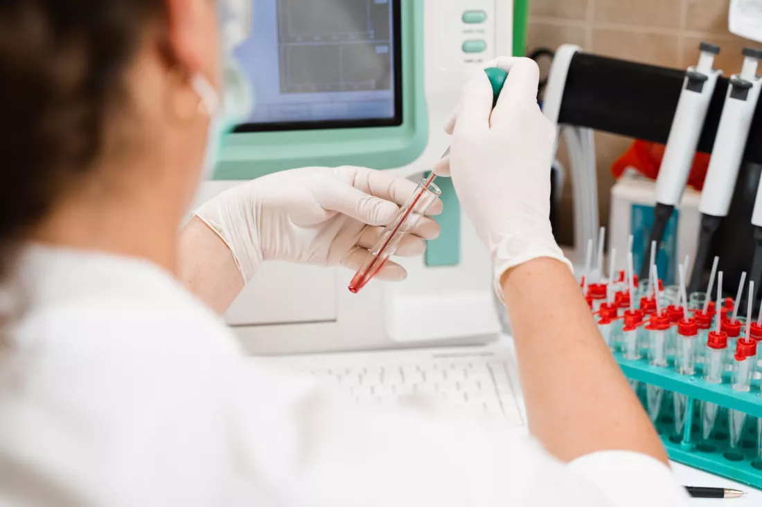 Diagnostka laboratoryjna pracuje przy analizatorze krwi
