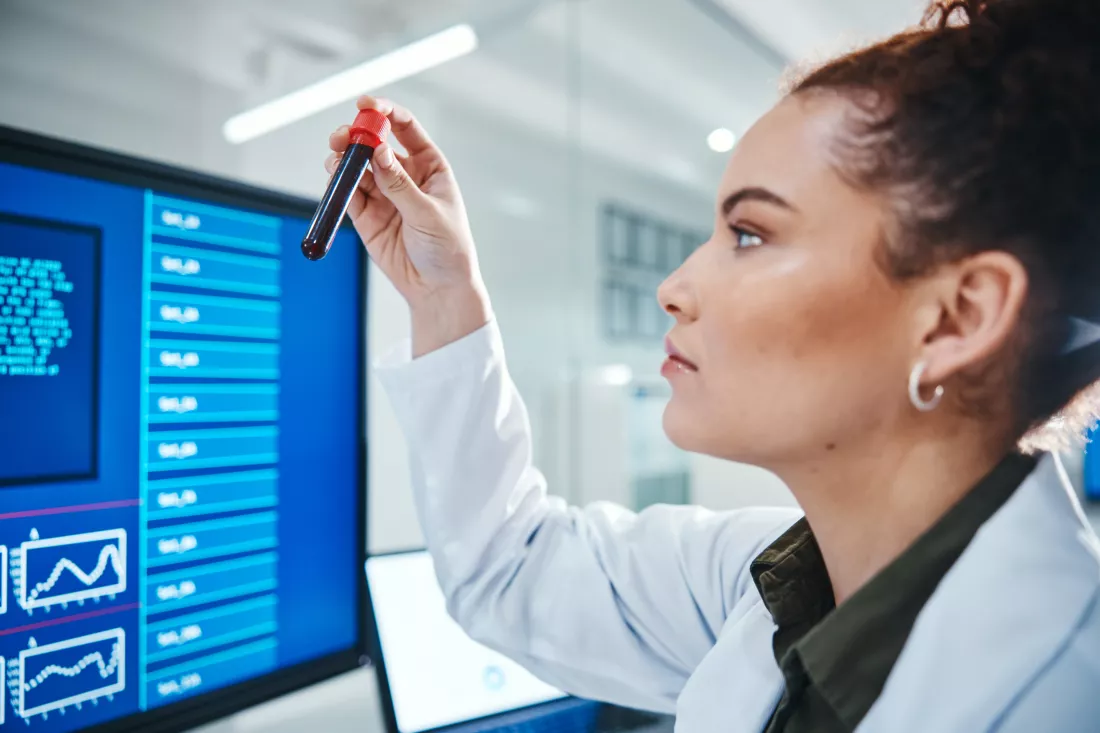 blood-computer-screen-science-with-woman-laboratory-development-innovation-research-dna-pharmaceuticals-test-tube-with-scientist-work-medical-pathology-discovery